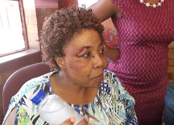 SA: Teacher Left Bleeding After 'Assault' By Grade 4 Pupil