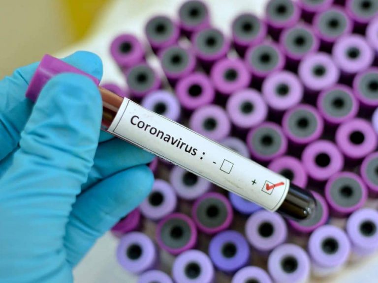 Nigeria’s Second Coronavirus Case Tests Negative