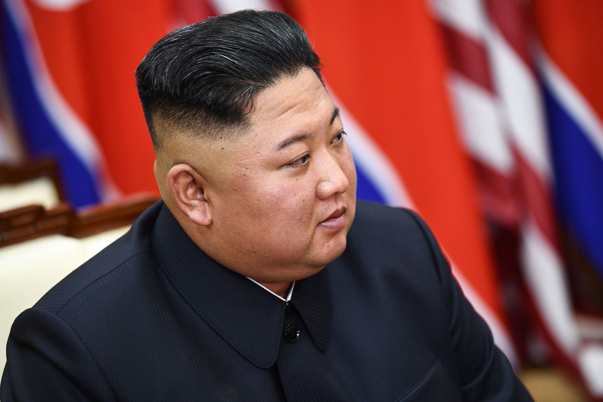 Kim Jong-Un In A Vegetative State After Botched Surgery