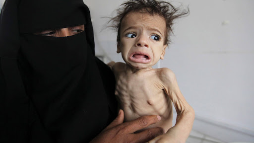 UNICEF Decries Looming Hunger In Yemen