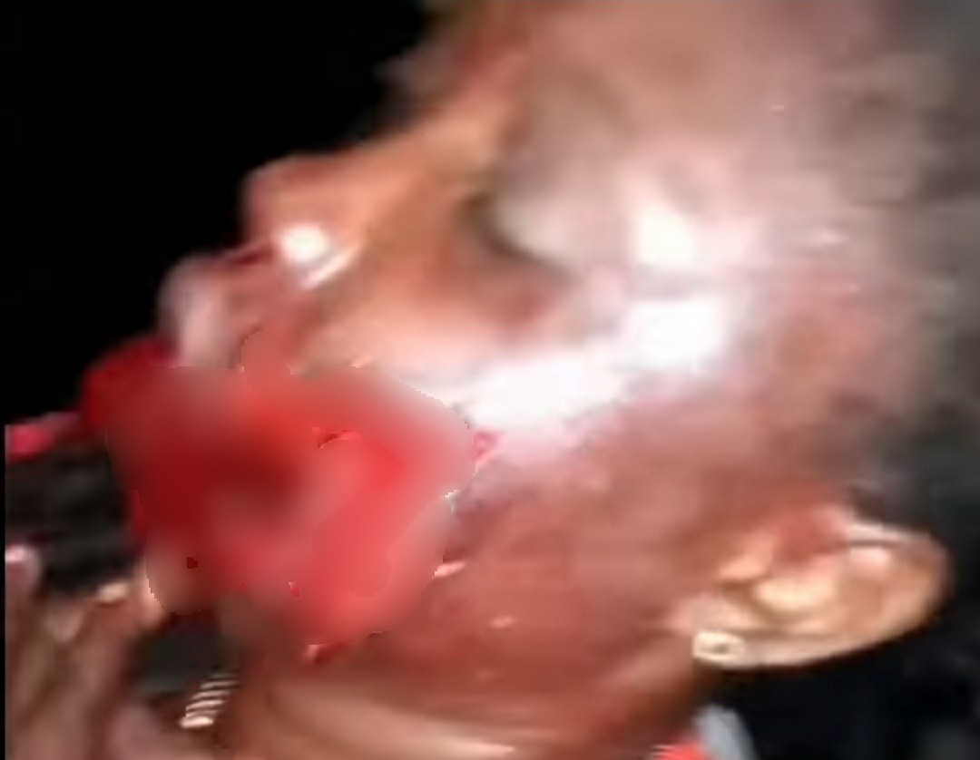Policeman Shoots Off Lady's Mouth For Breaking Up With Him