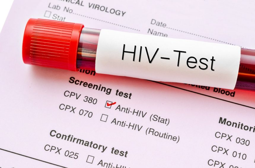 People Living With HIV Now Get Drugs To Last For Three Months